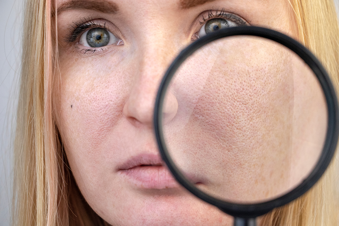 How-to-Get-Rid-of-Clogged-Pores-for-Clearer-Skin