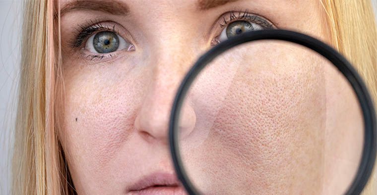 How-to-Get-Rid-of-Clogged-Pores-for-Clearer-Skin