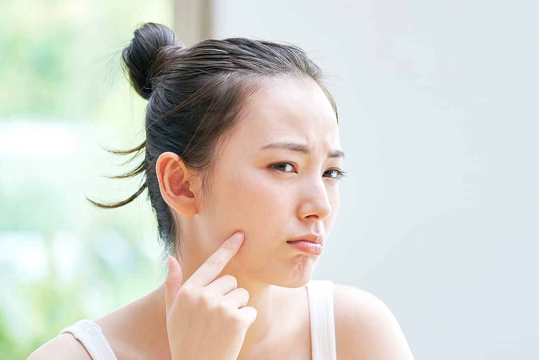 Skin-Type---Dry-Skin